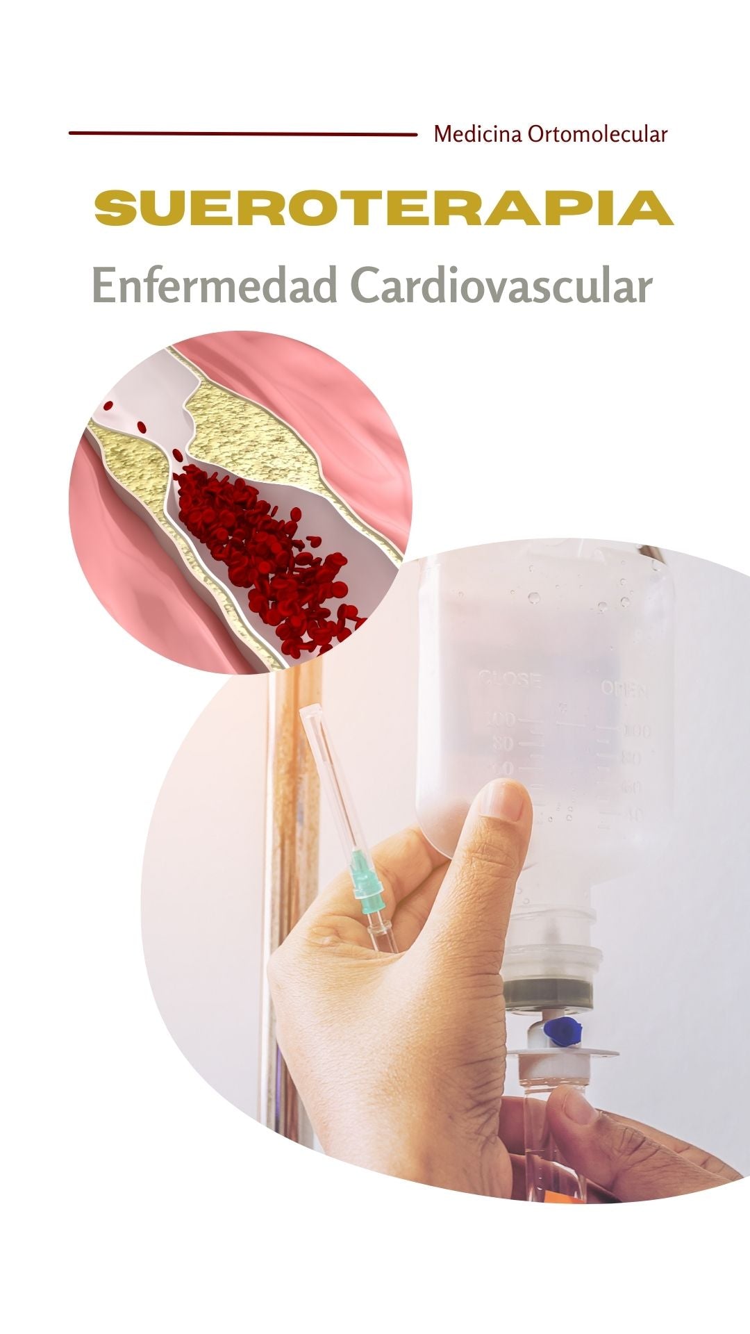 Sueroterapia Cardiovascular